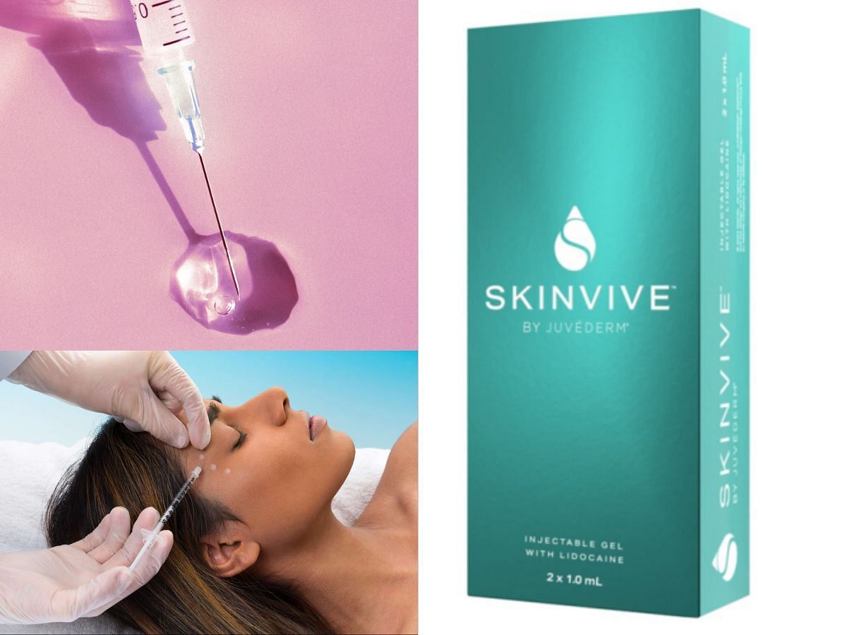 Skinvive: The new hyaluronic acid filler injection (Image via Sportskeeda)