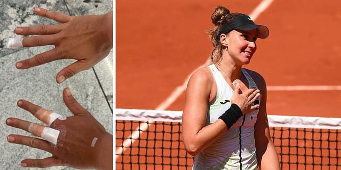 Beatriz Haddad Maia has freak accident in hotel room at Guadalajara Open, withdraws from tournament after sustaining multiple cuts on her body