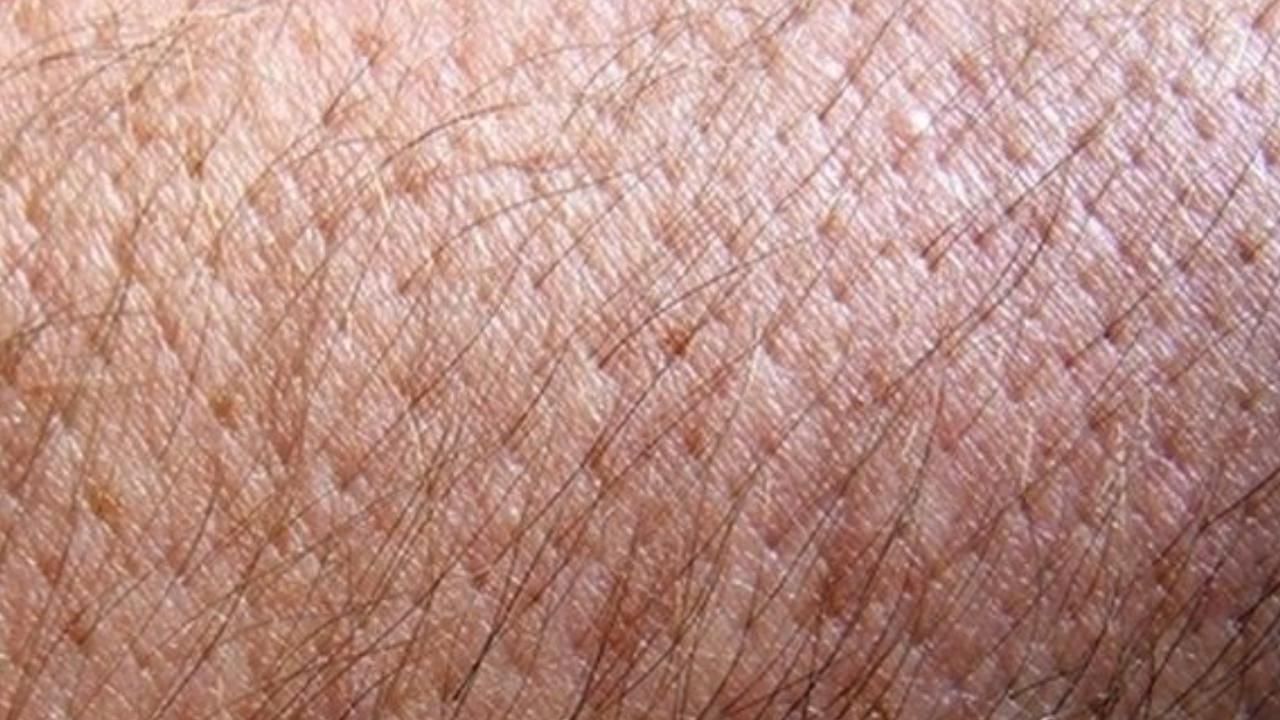 Removing fiberglass from skin (Image via YouTube)