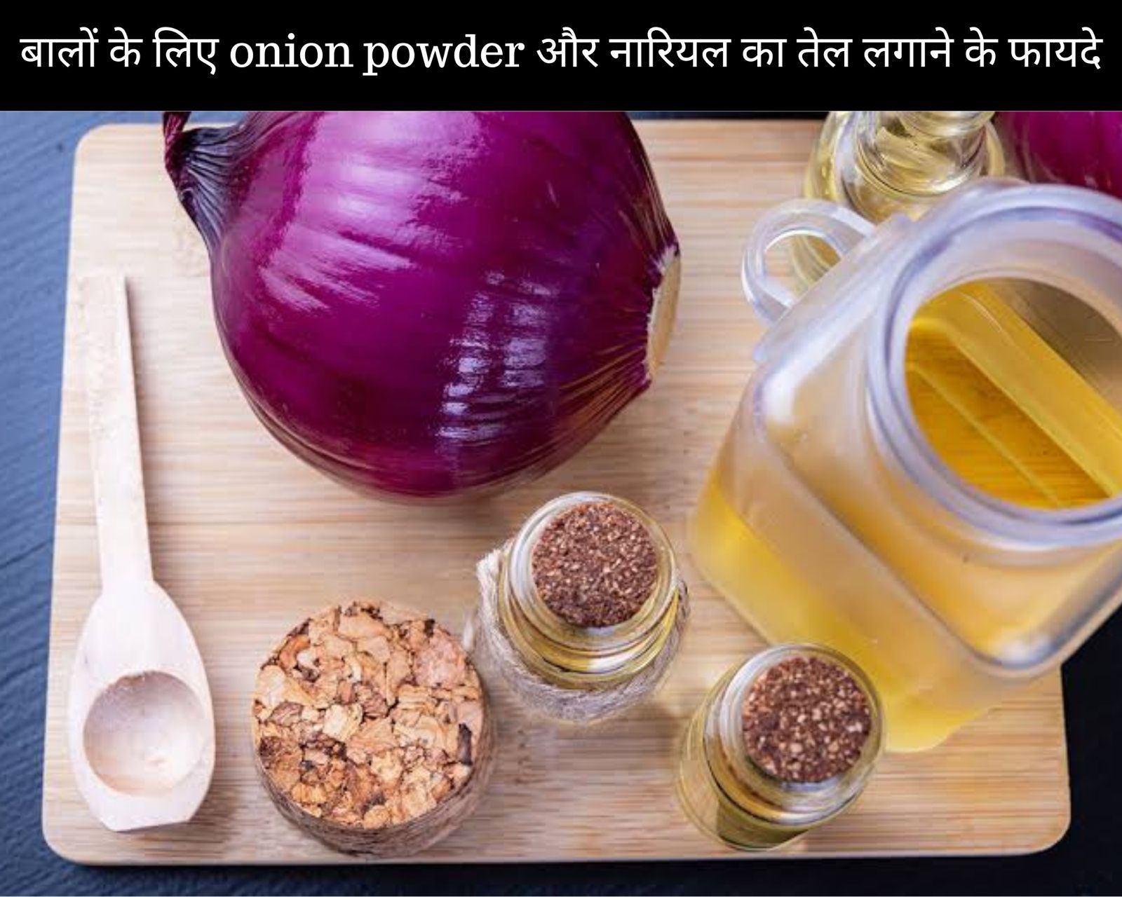 बालों के लिए onion powder और नारियल का तेल लगाने के 10 फायदे (फोटो - sportskeedaहिन्दी)