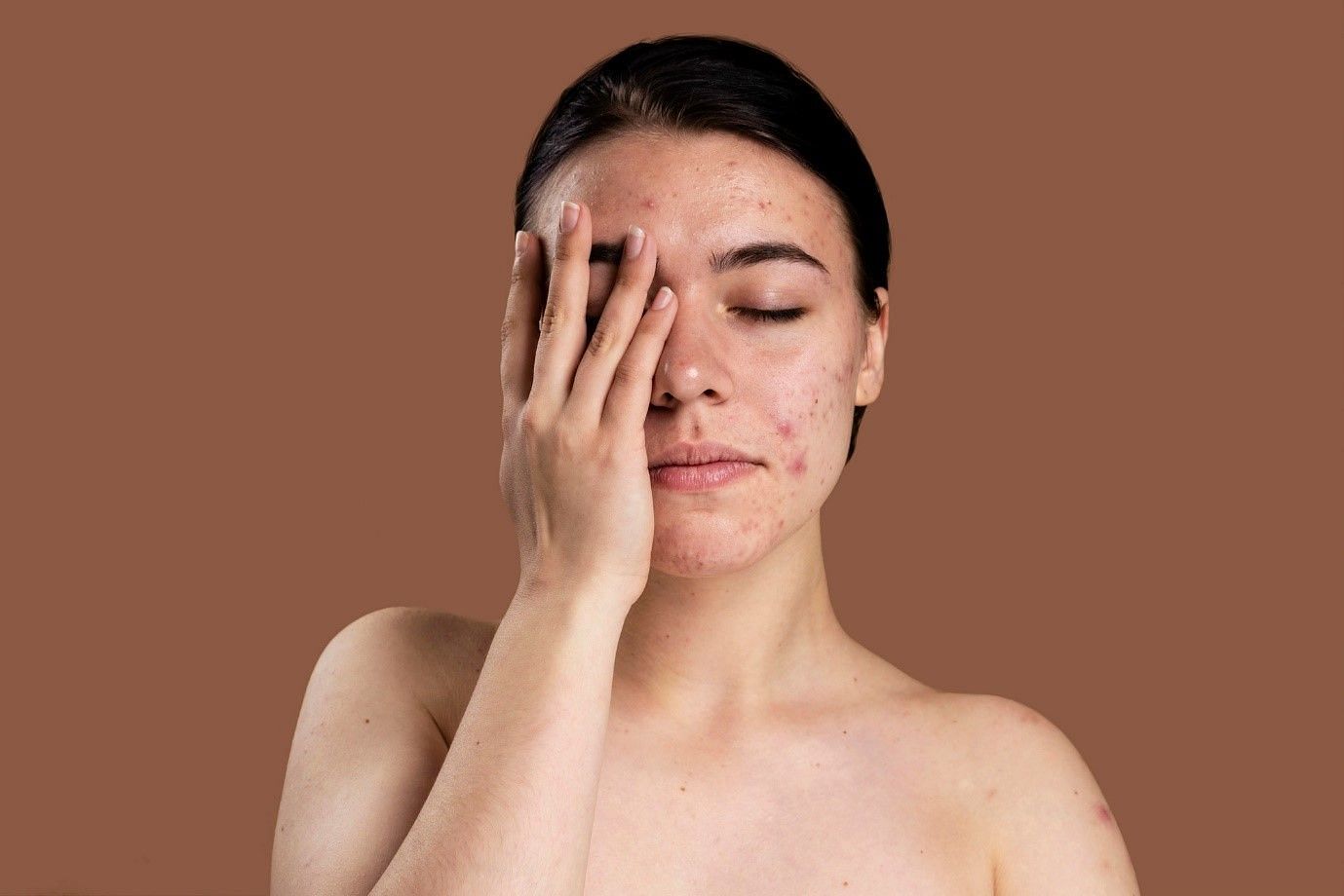 Use a facewash with ingredients like vitamin C and niacinamide to reduce acne marks (Image by Freepik)