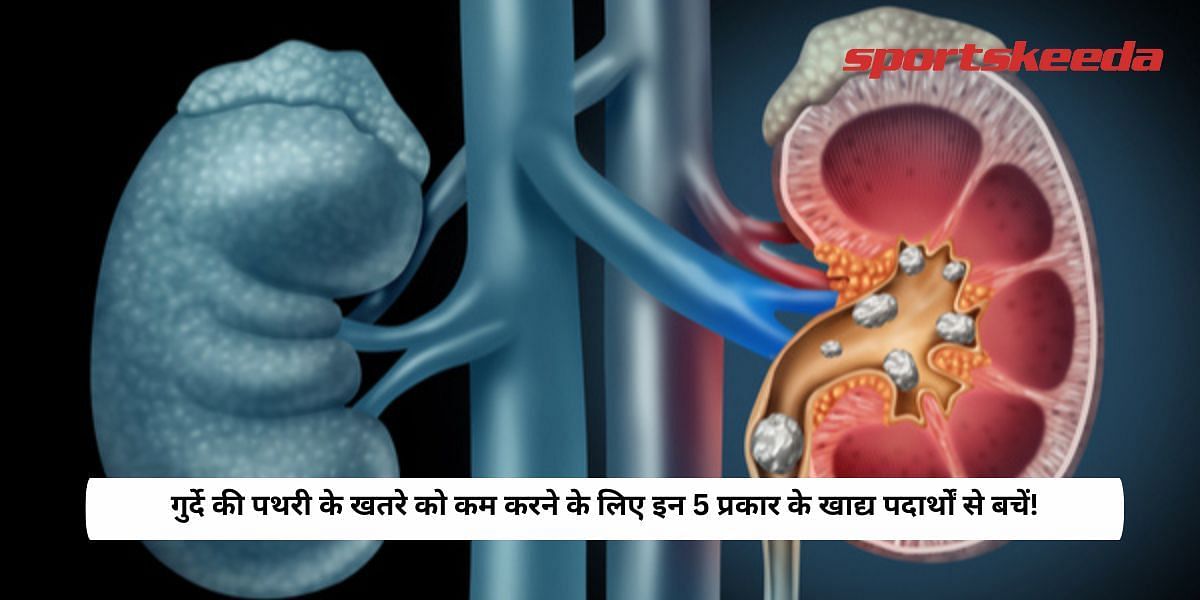 Avoid THESE 5 Food Types To Reduce The Risk Of Kidney Stones!