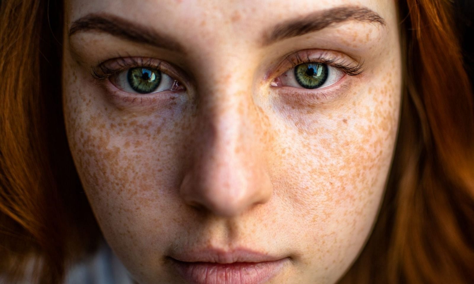 Sunspots on face (Image via Getty Images)