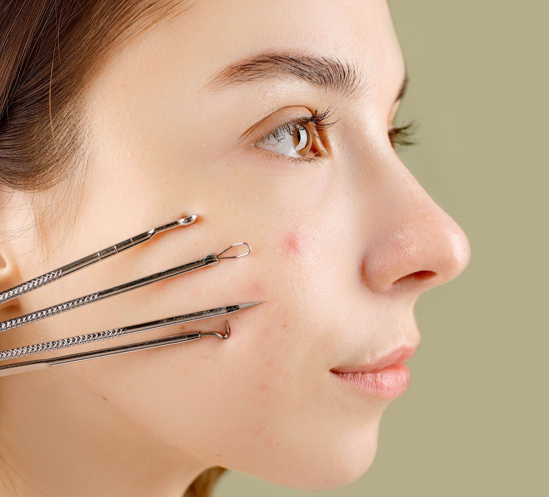 How to deal with acne scarring (Image via Pexels / Anna Nekrashevich)