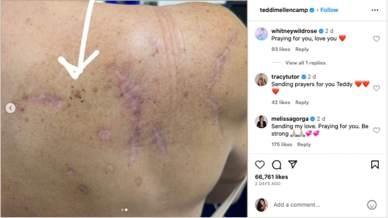 Famous Real Housewives show support to Teddi on her latest cancer update on Instagram.