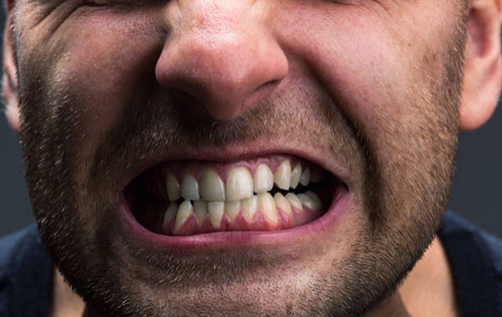 Jaw pain from stress is often a symptom of anxiety. (Image by iStockphoto via Pexels)