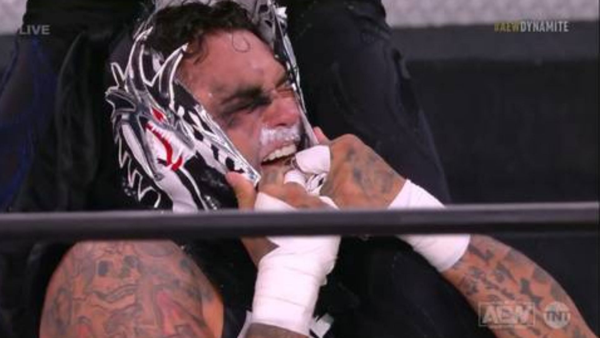 This brutal attack was the first chance AEW fans got a good look at Penta&#039;s face.