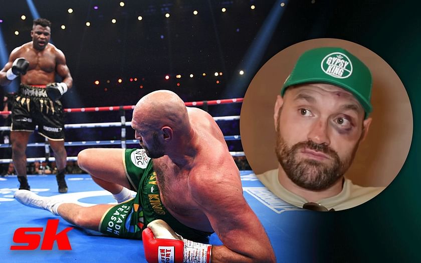 He Didnt Really Get Me A Bruised Tyson Fury Tries To Shrug Off Knockdown By Accusing 2135