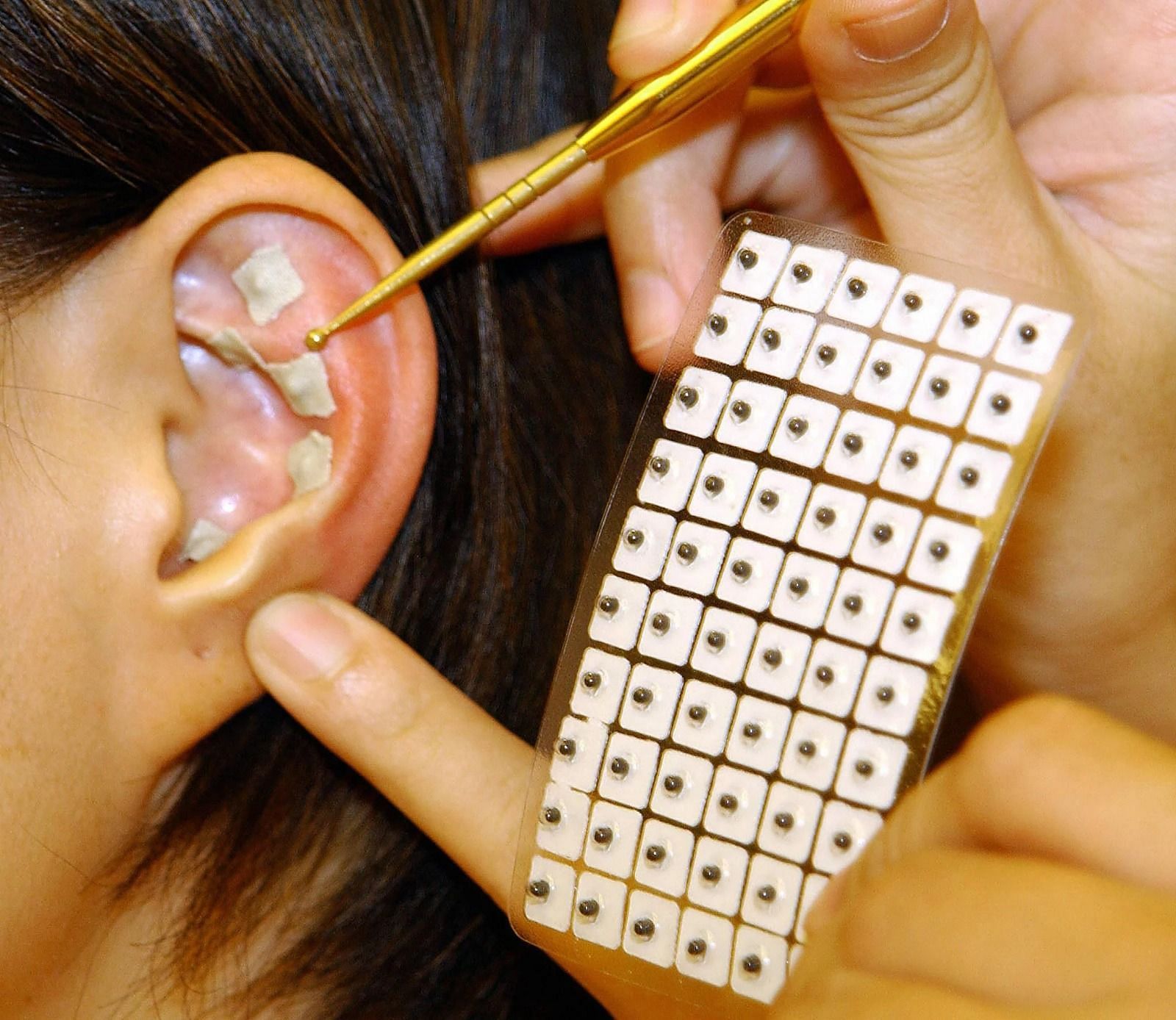 Ear-Seeding (Image via Getty Images/SAM YEH)