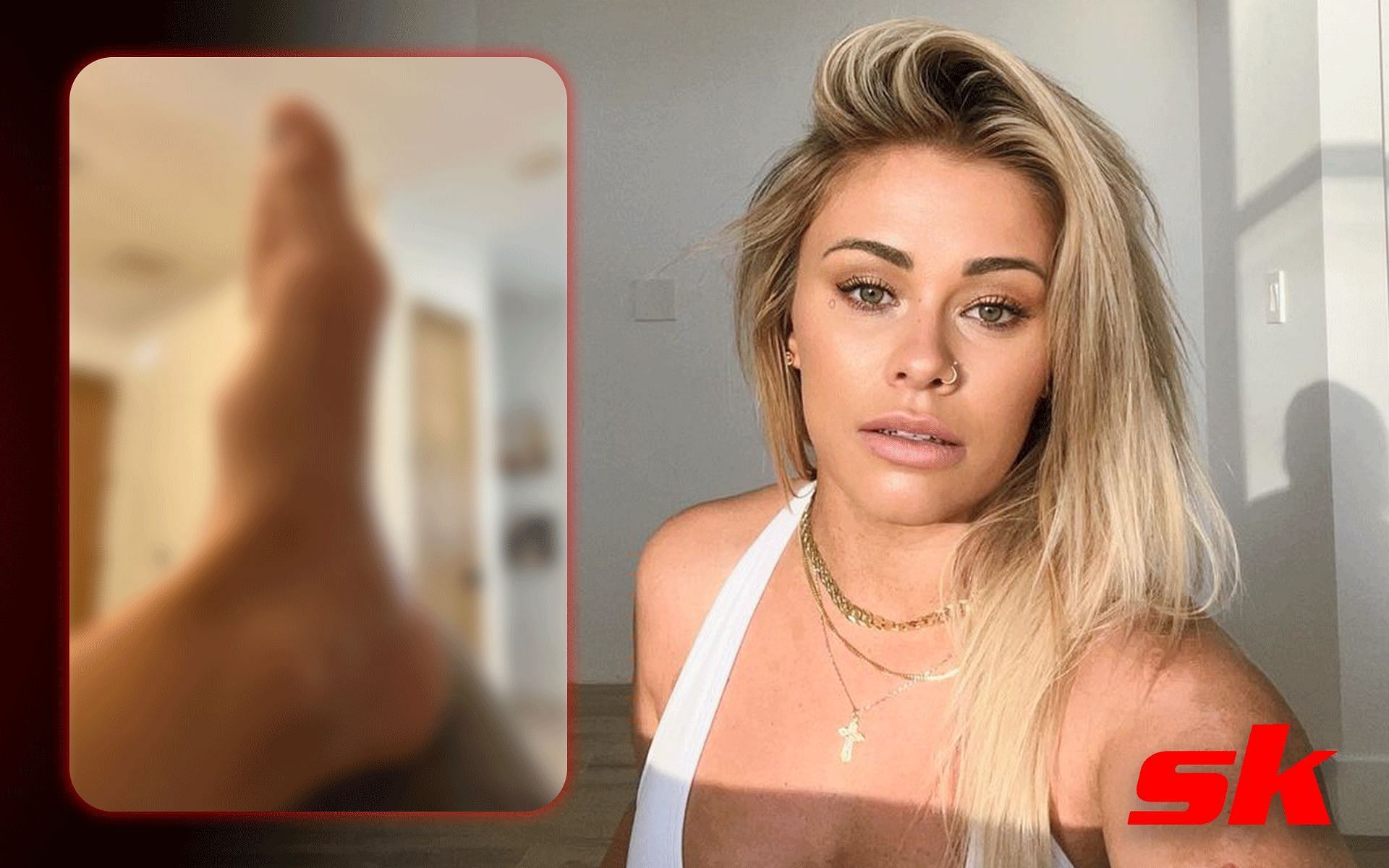 Paige VanZant injury [Images via: @paigevanzant on Instagram]