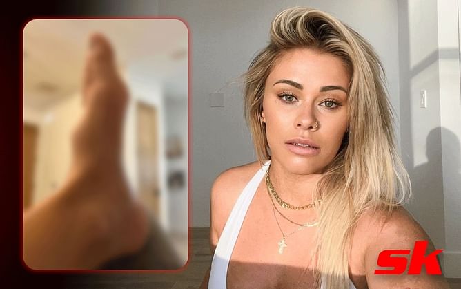 Paige VanZant shows off freak foot injury suffered in shower mishap