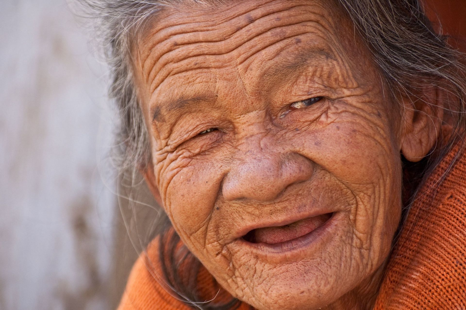 Premature aging due to lack of SPF (image sourced via pexels / photo by Pixabay)