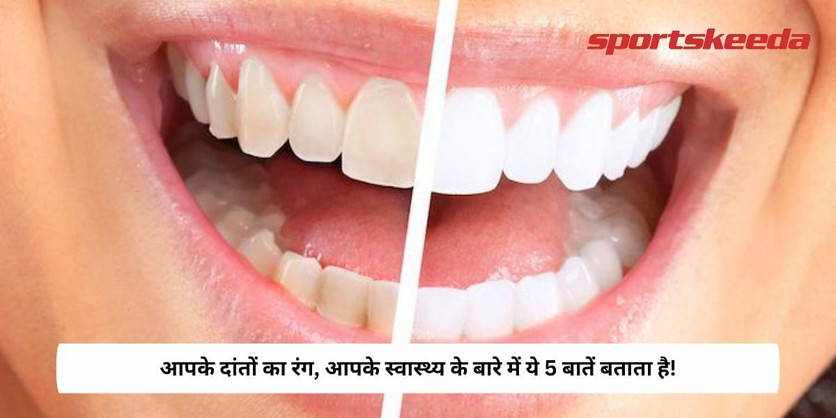 5 Things The Colour Of Your Teeth Say About Your Health!