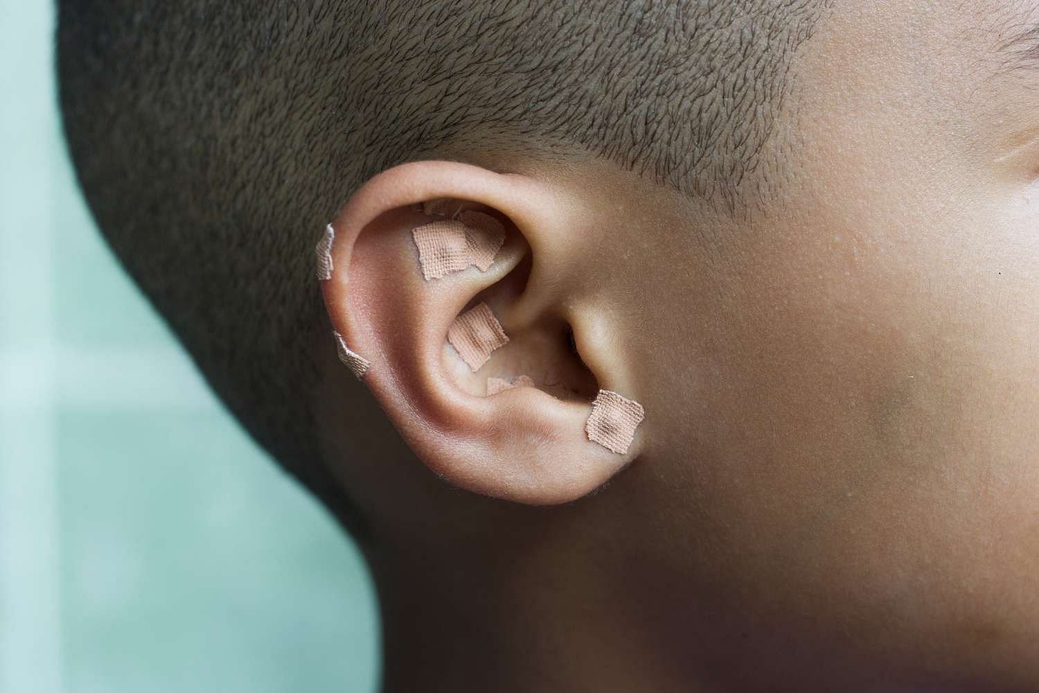 Ear-Seeding (Image via Instyle)