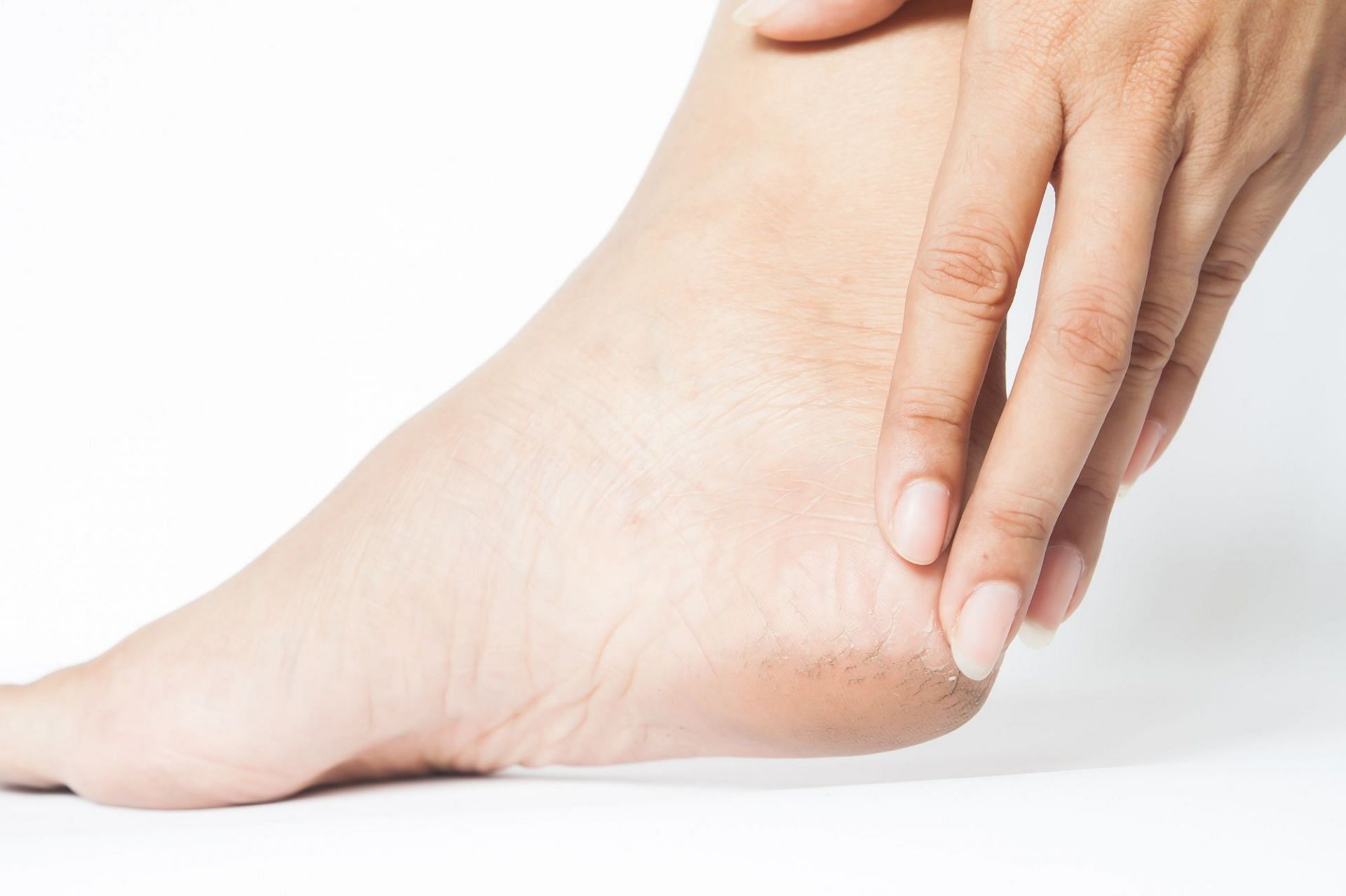 7-reasons-you-have-itchy-ankles-at-night