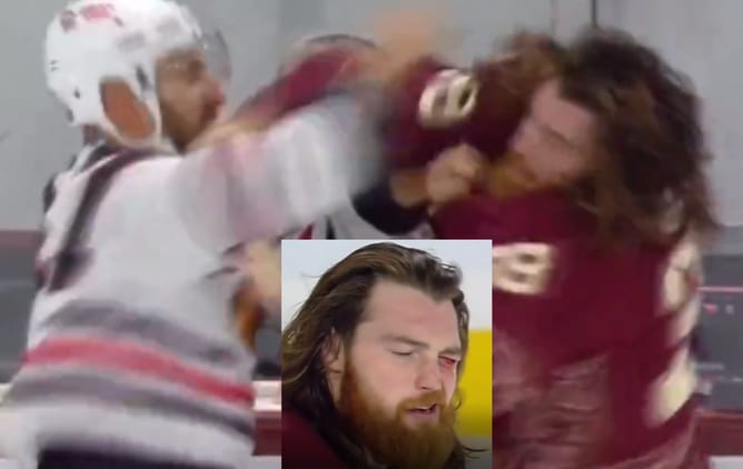 VIDEO: Nick Foligno's draws blood as blows cut O'Brien's left eye in fight