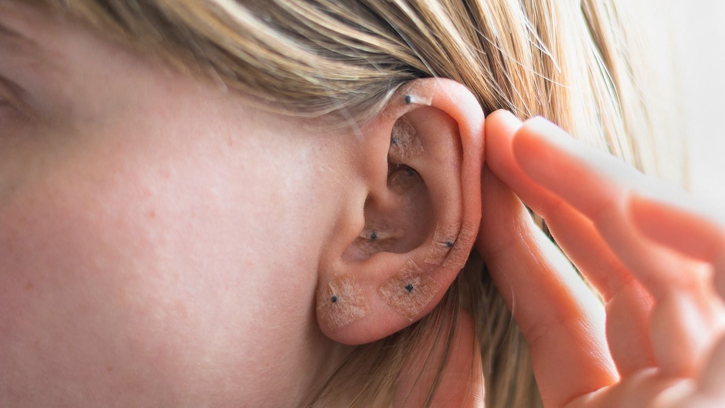 Ear-Seeding (Image via Shutterstock/ Don Ye)