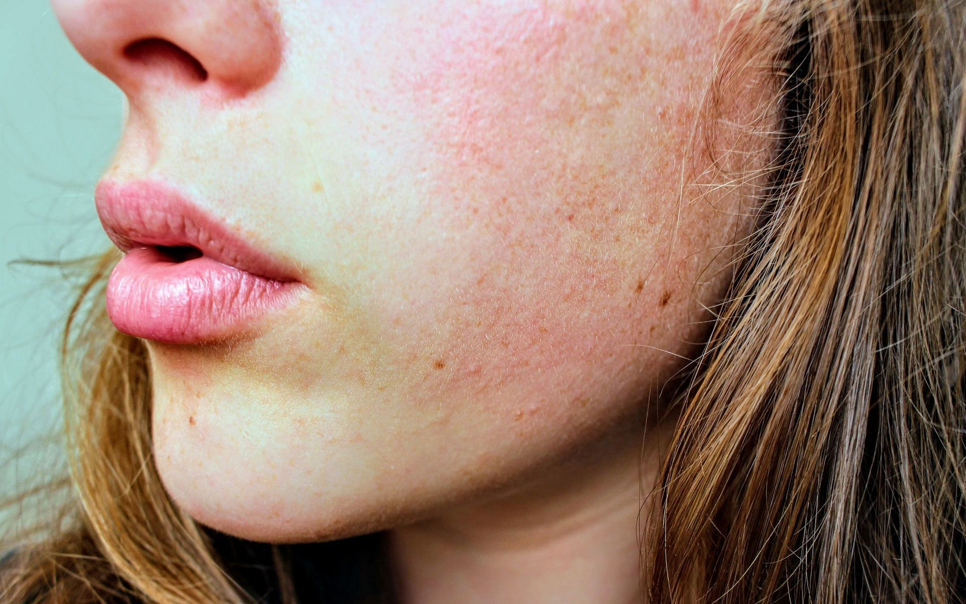 Dry skin on face (image sourced via Pexels / Photo byJenna Hamra)