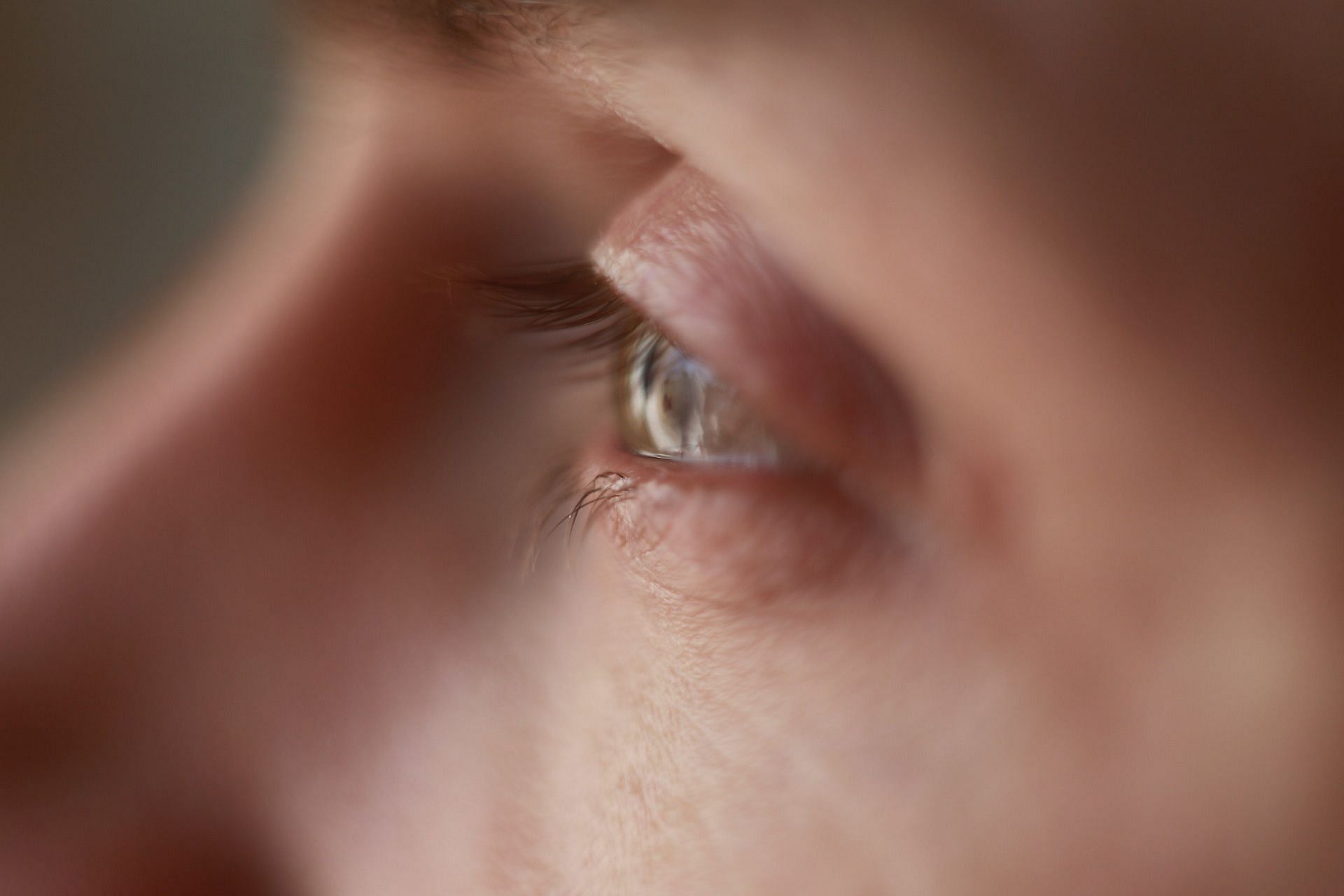 causes of rash around eyes (image sourced via Pexels / Photo by Victoria)