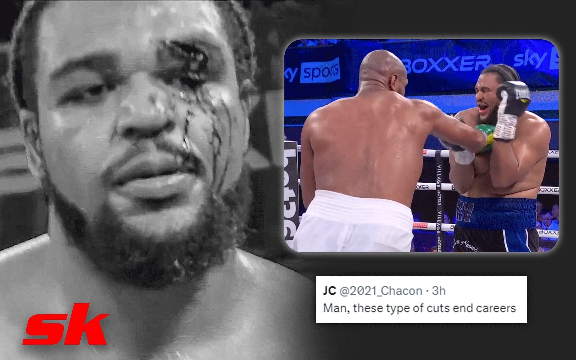 Jeamie TKV suffers a gruesome injury [Image credits:@ boxxer and @SkySportsBoxing on Twitter]