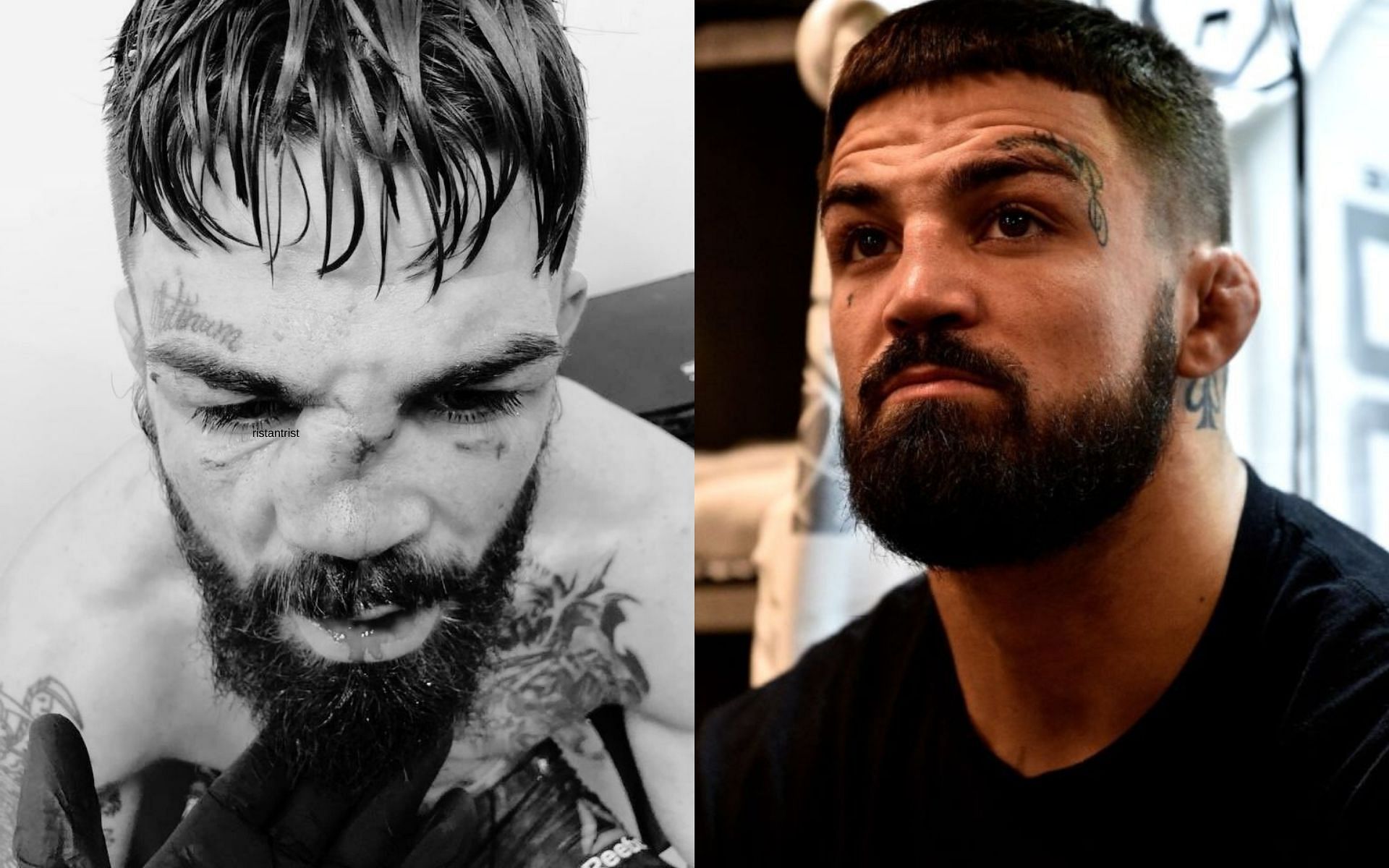 Mike Perry nose injury: How did Mike Perry break his nose? The horrific ...