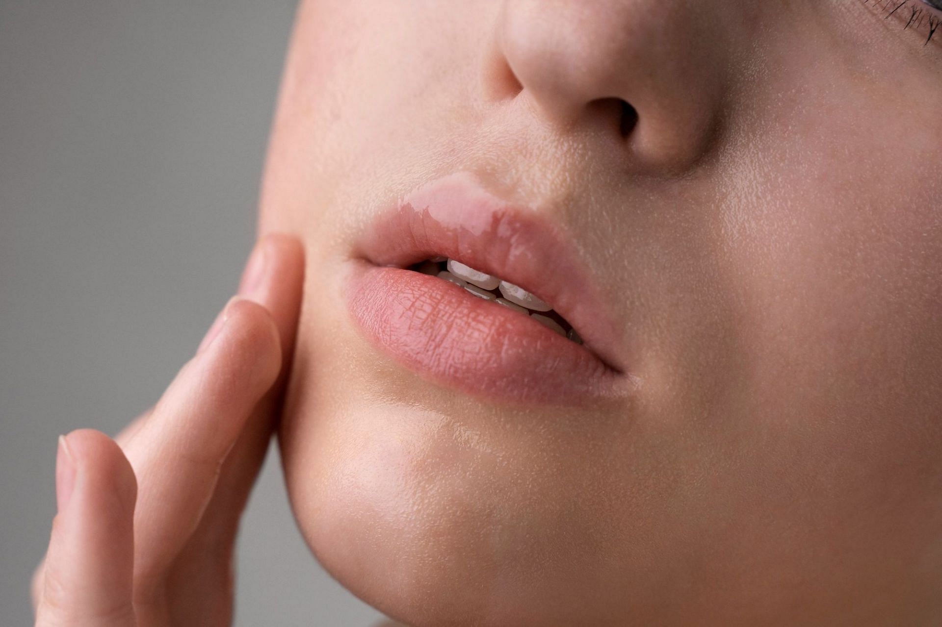 what-are-some-of-the-reasons-for-dry-skin-around-mouth-and-how-can-it