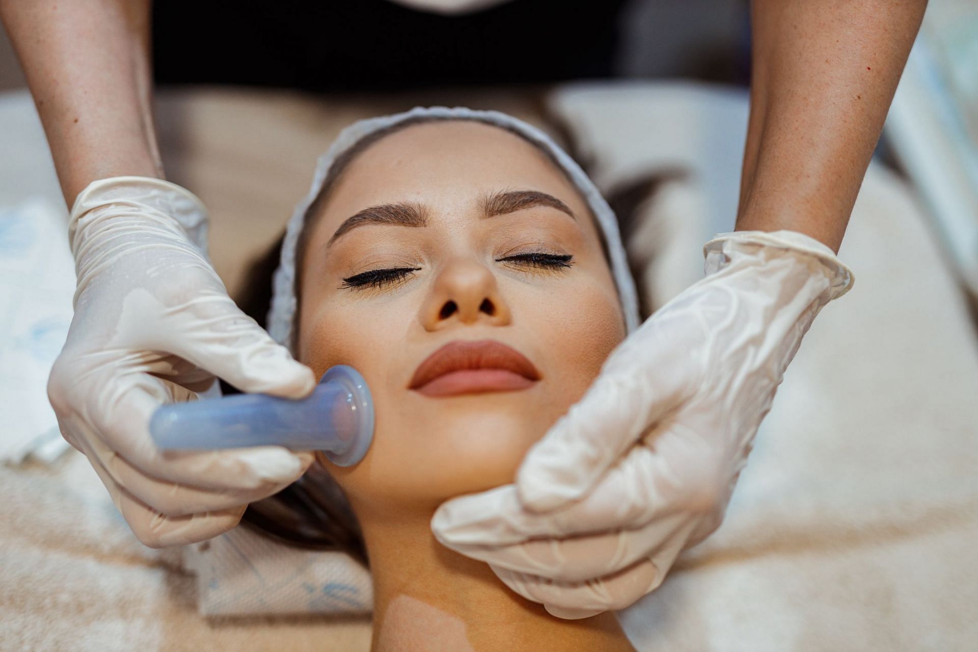 Facial Cupping (Image via Getty Images/cream-ph)