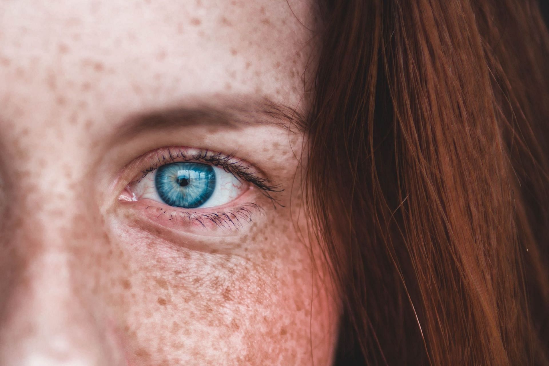 Pineapples can help prevent acne and pimples. (Image via Unsplash/ Erik Mclean)