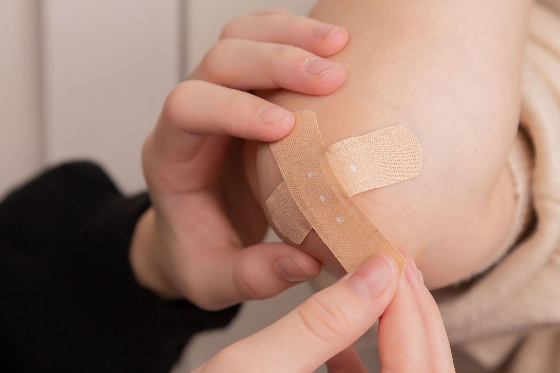 The anti-bacterial properties accelerate wound healing (Image via Unsplash/Diana Polekhina)