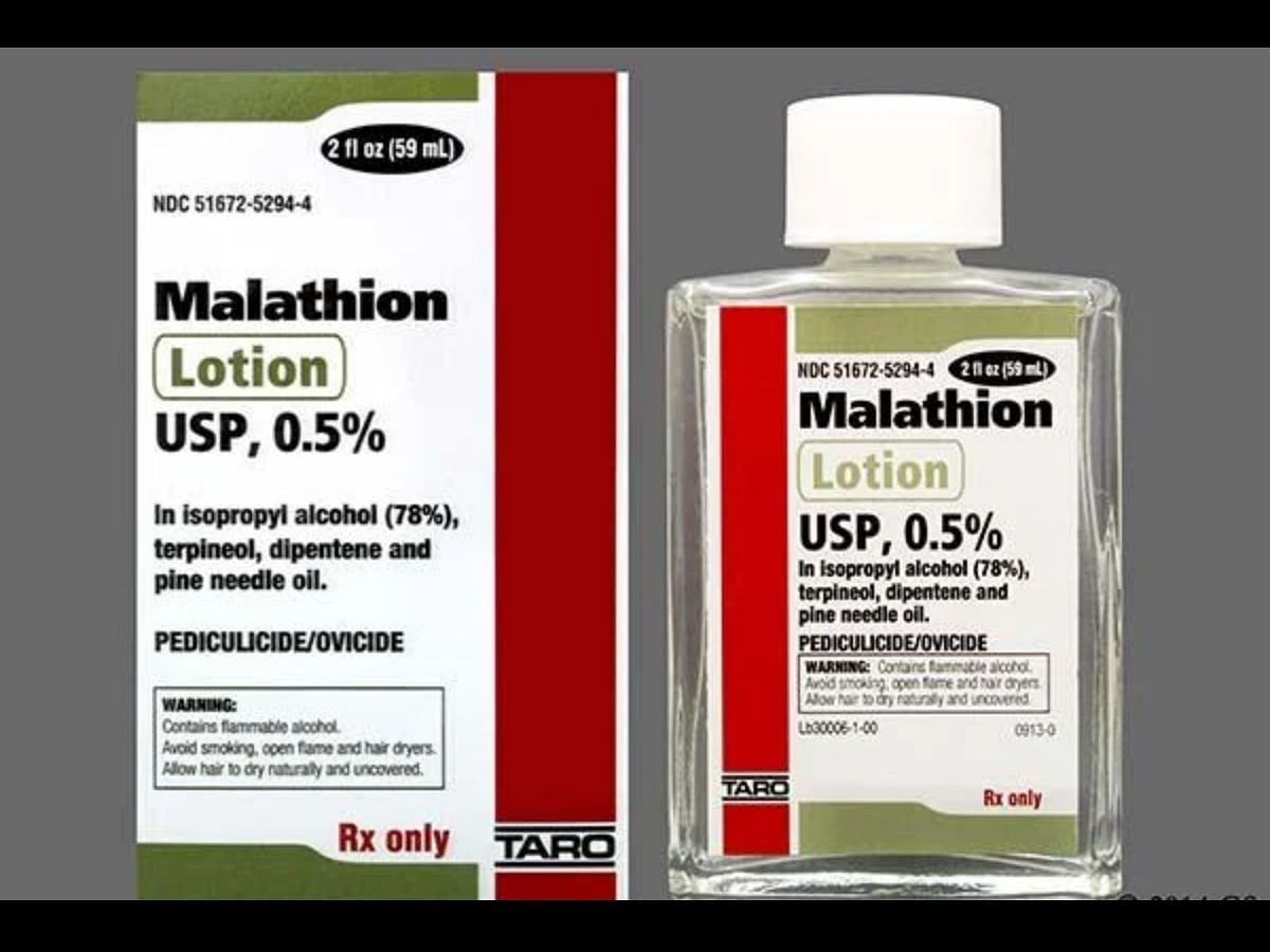 Malathion Ovide Lotion lice treatment (Image via goodrx.com)