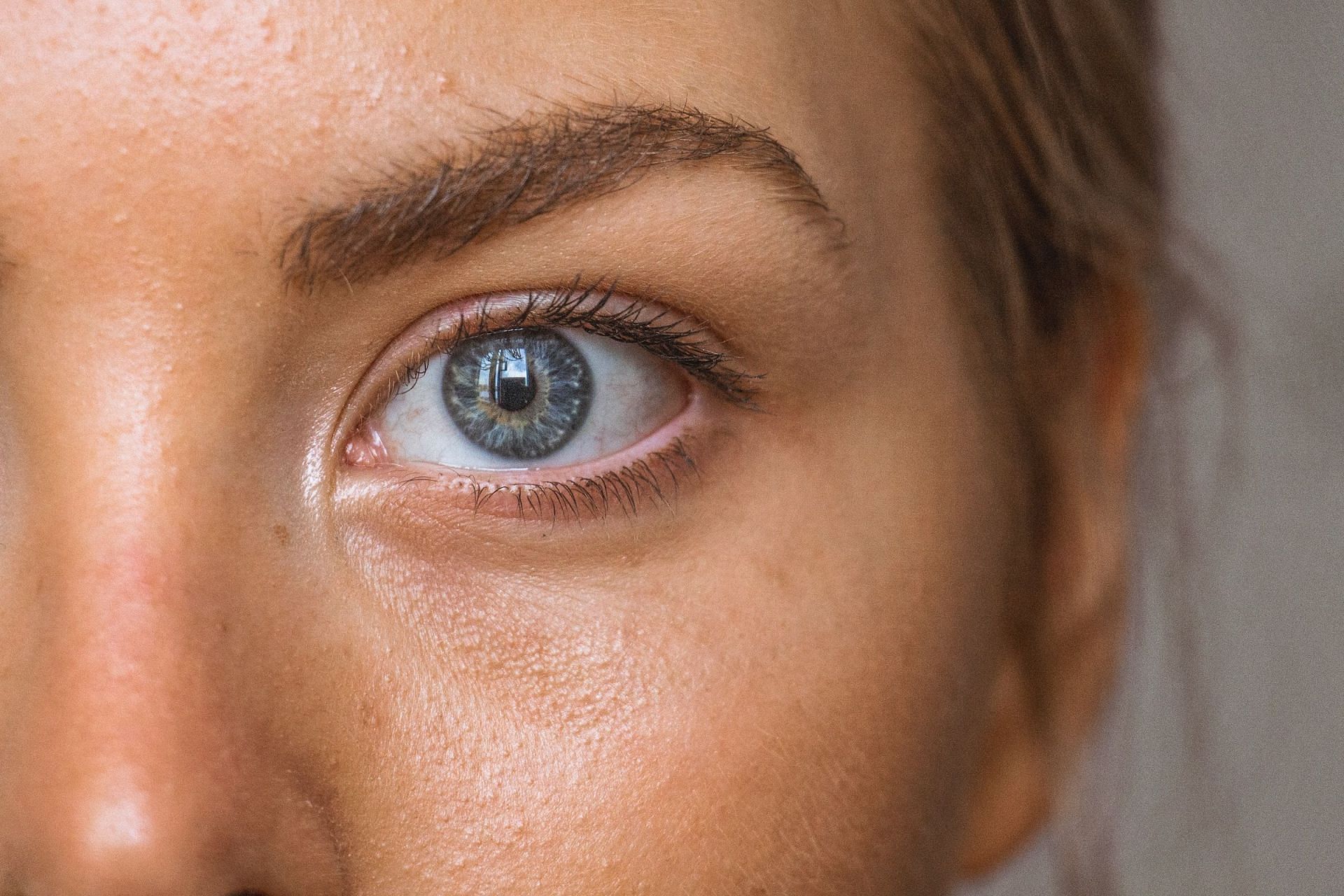 Skin dryness is a common sign of this condition (Image via Unsplash/Amanda Dalbj&ouml;rn)