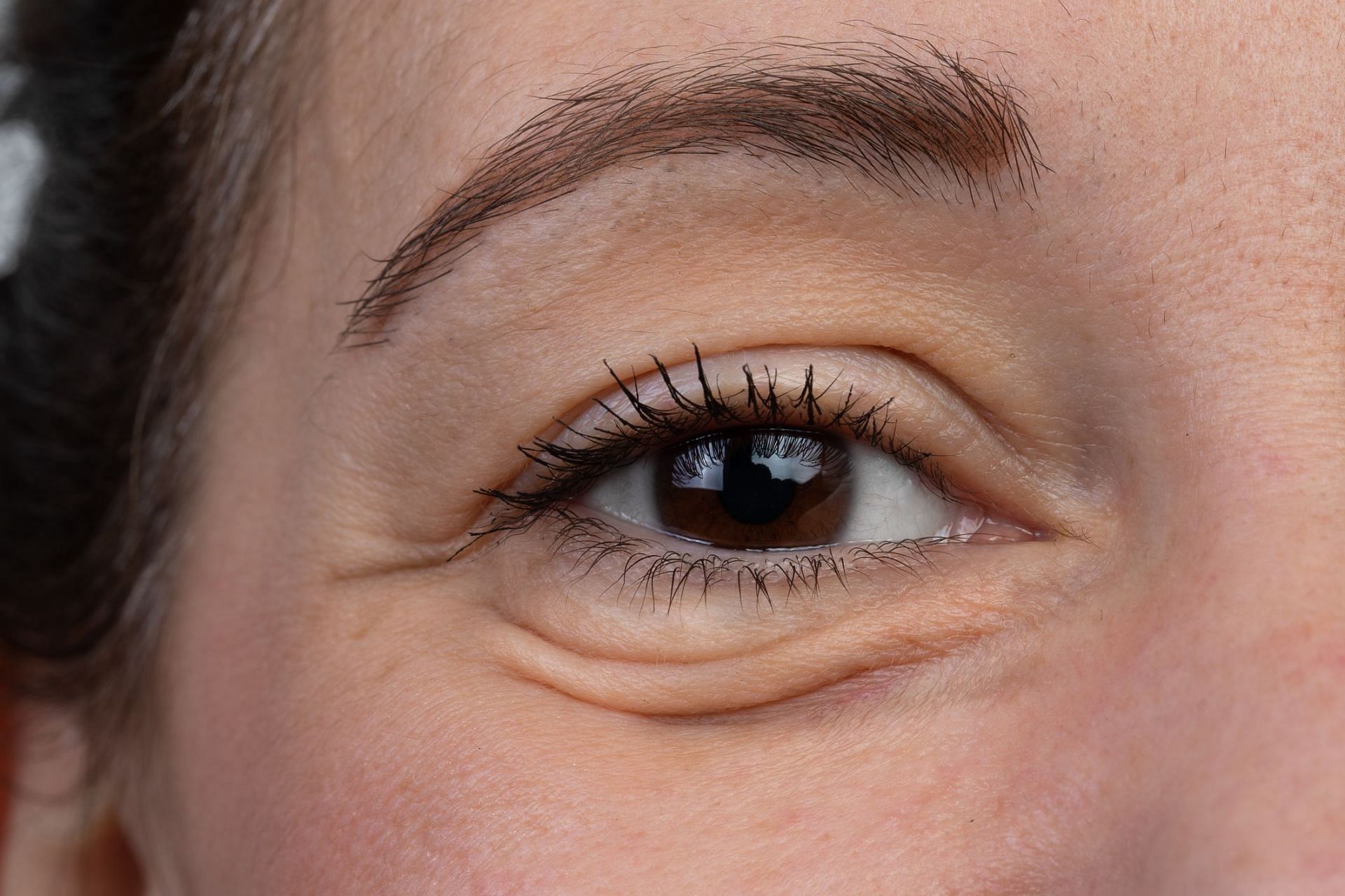 Sunken eyes (Image via Getty Images/Srulik)