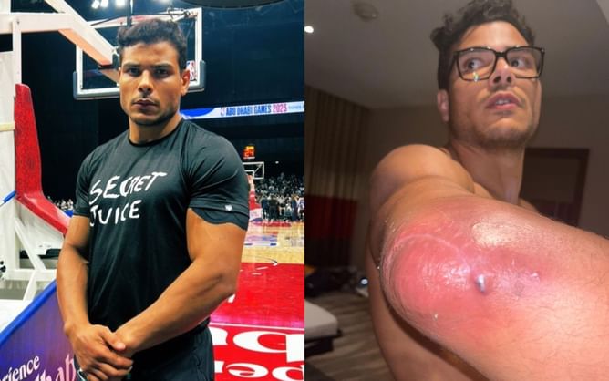 Paulo Costa tried to keep elbow injury a secret from the UFC; gives detailed post-surgery update and fight status