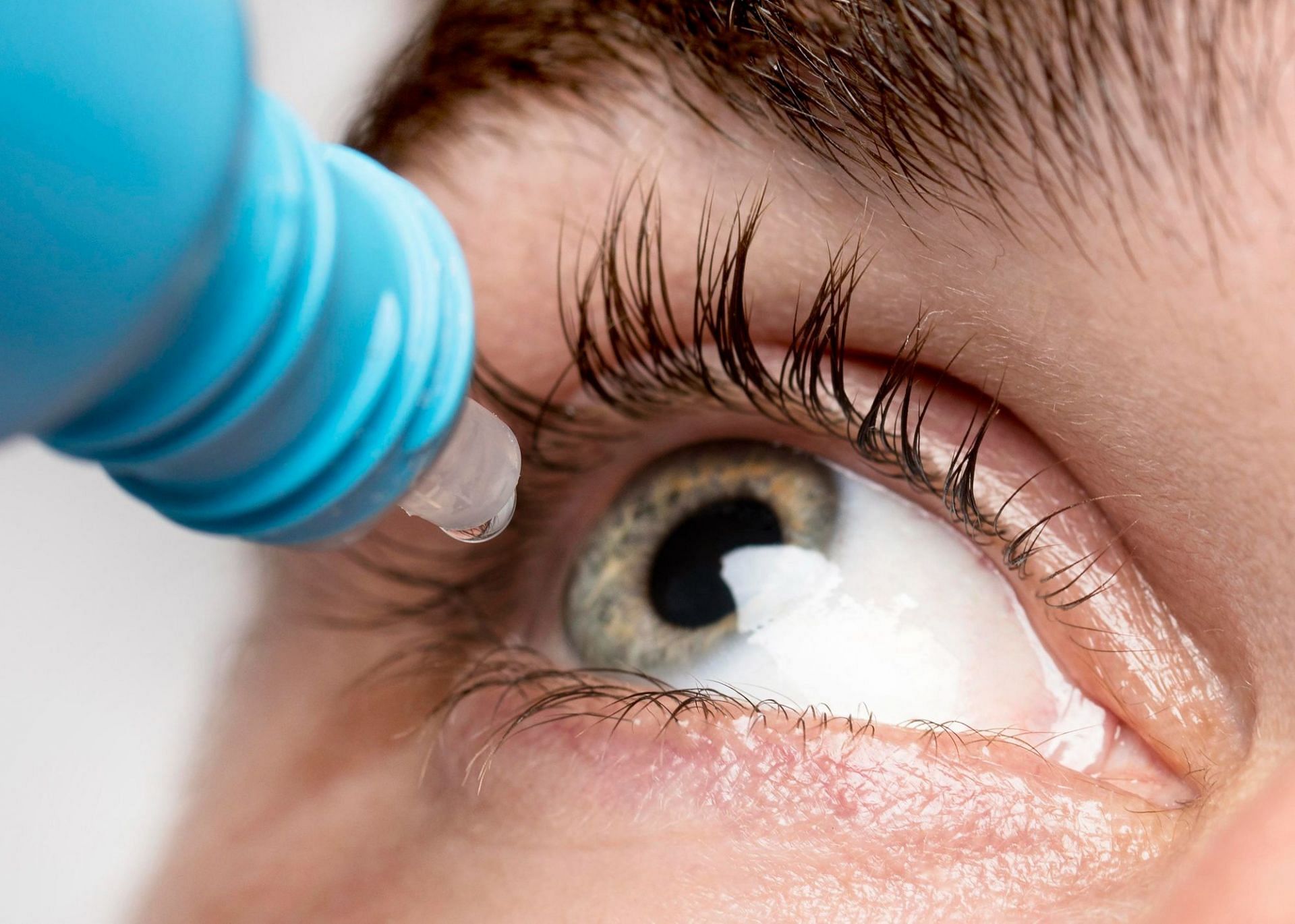 Prescription and over-the-counter eye drops can help. (Image via Freepik)