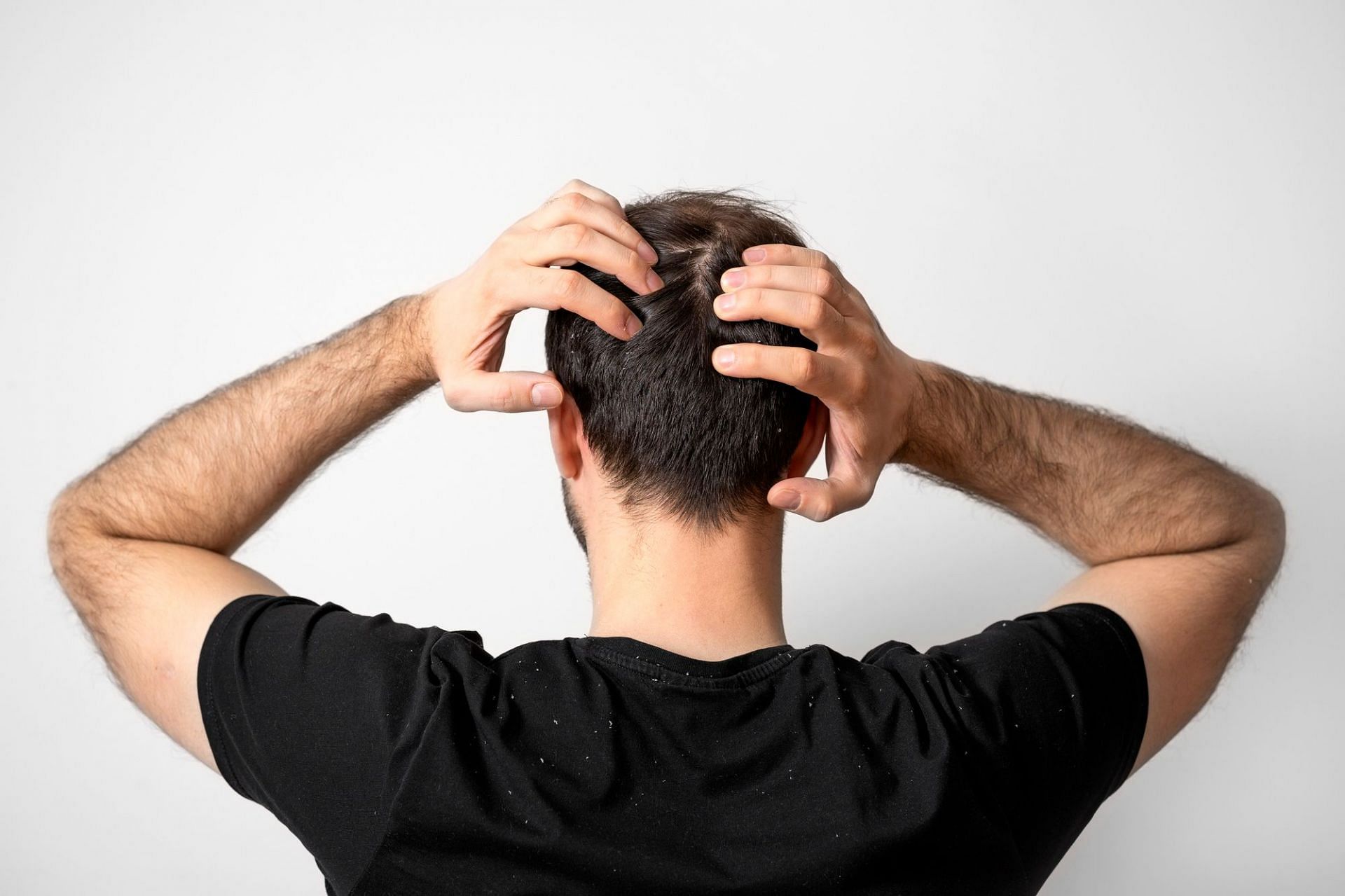 Sore scalp can be a very uncomfortable and distressing condition (Image by Freepik)