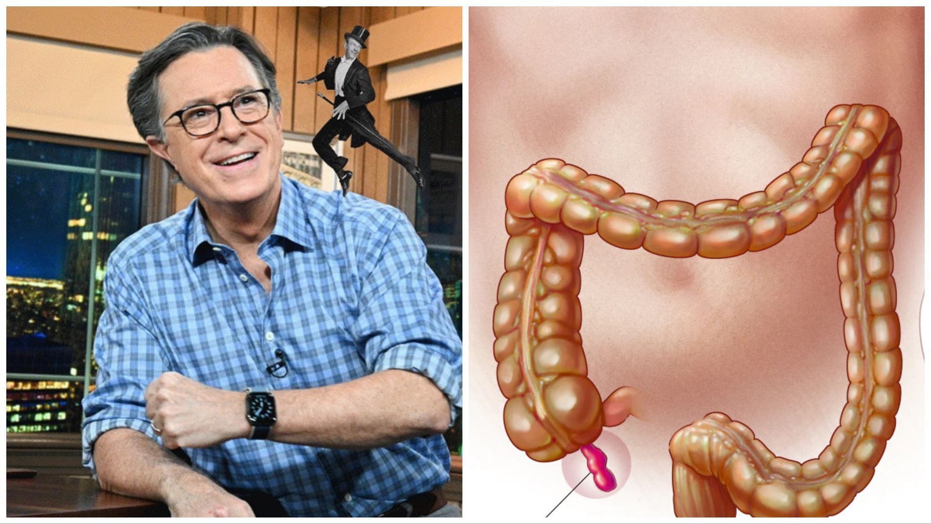 Ruptured Appendix What Is A Ruptured Appendix Stephen Colberts “the Late Show” On Hold As He 