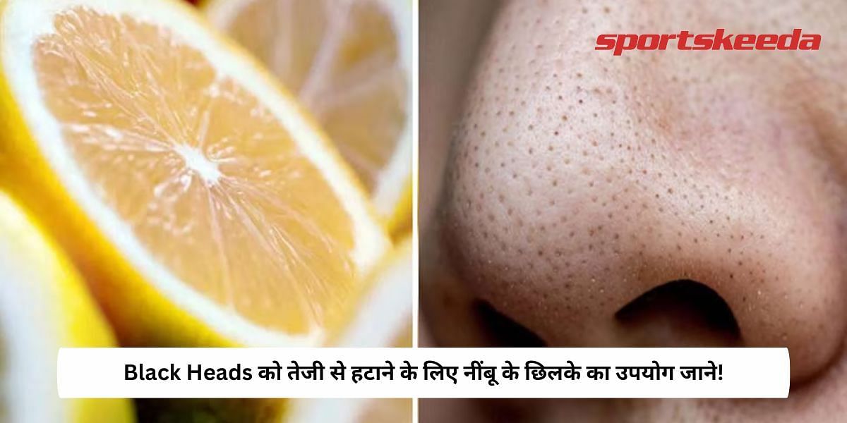 How To Use Lemon Peel To Remove Black Heads Fast!