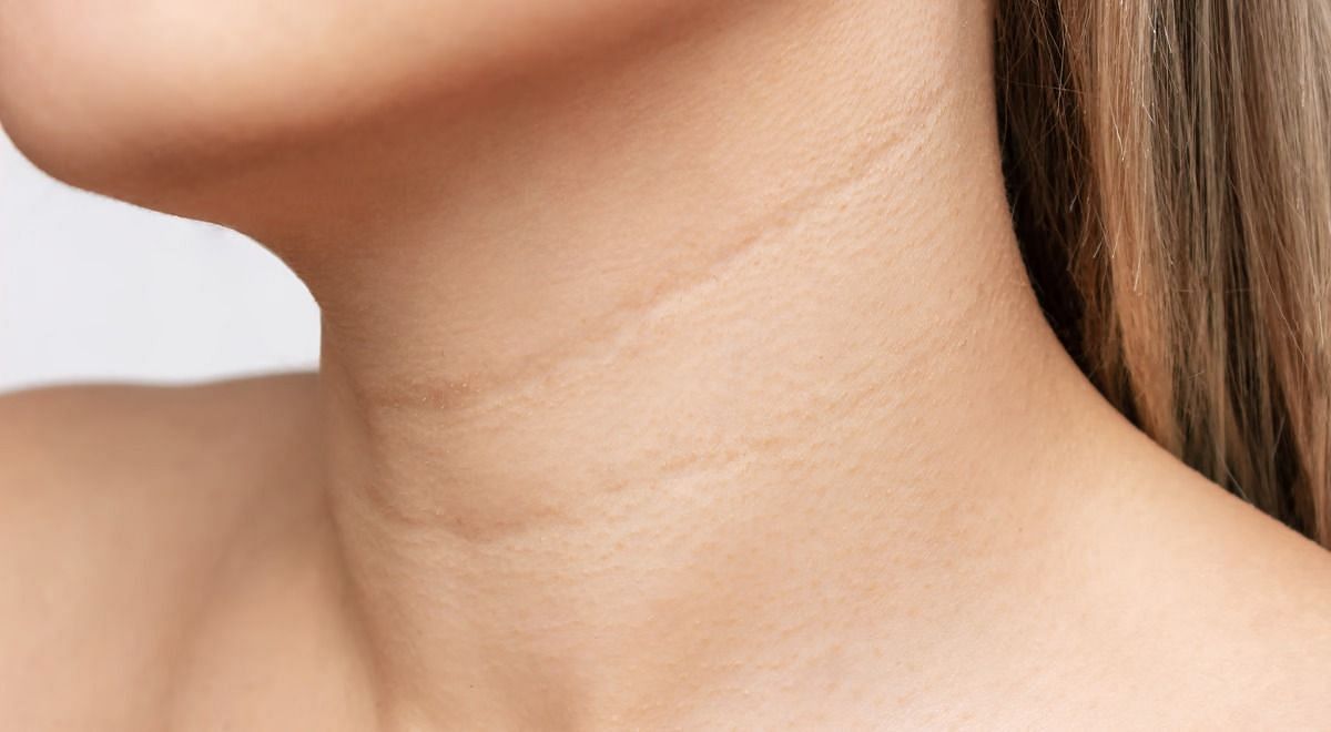 Wrinkled neck (Image via Getty Images)