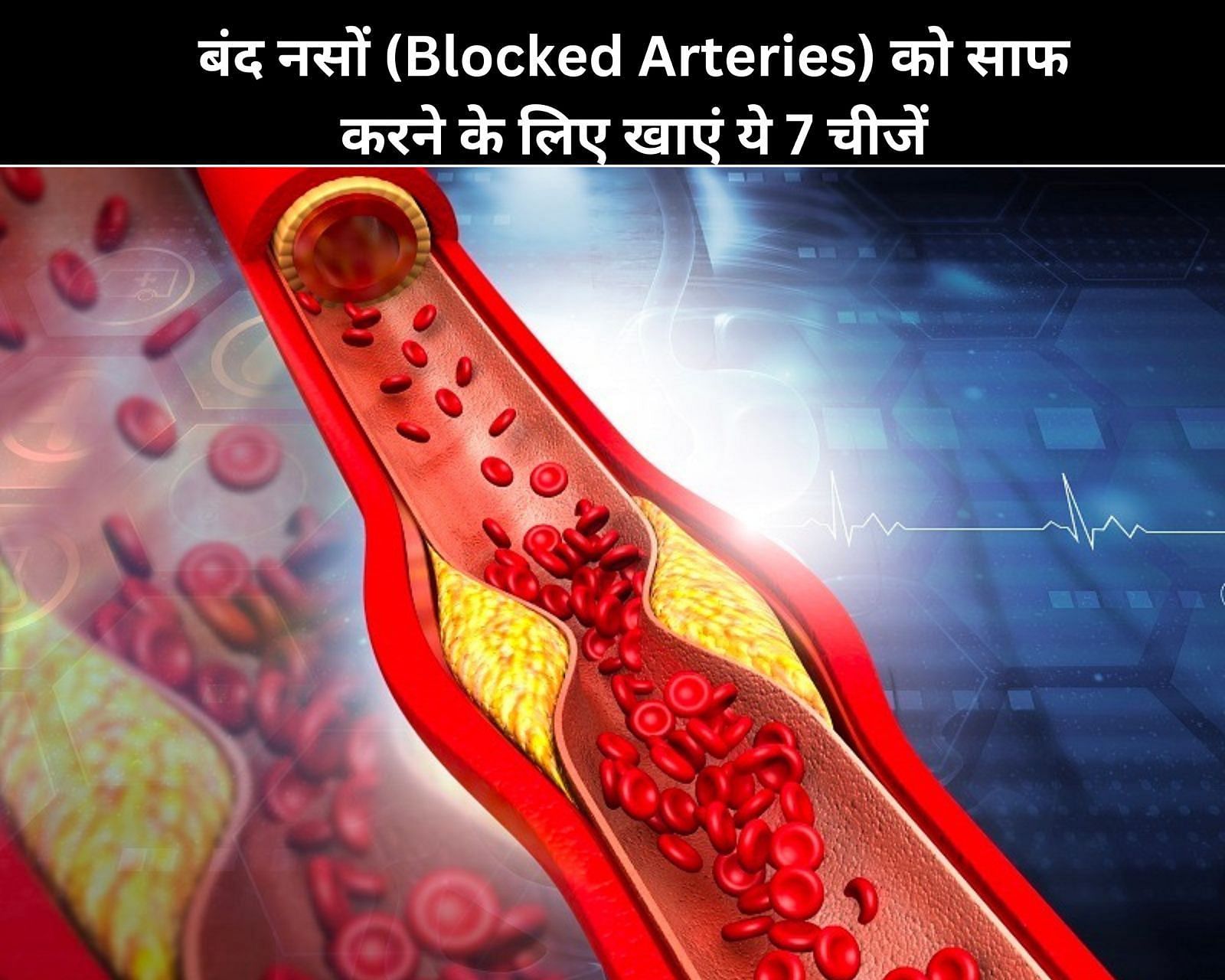 बंद नसों (Blocked Arteries) को साफ करने के लिए खाएं ये 7 चीजें (फोटो - sportskeedaहिन्दी)