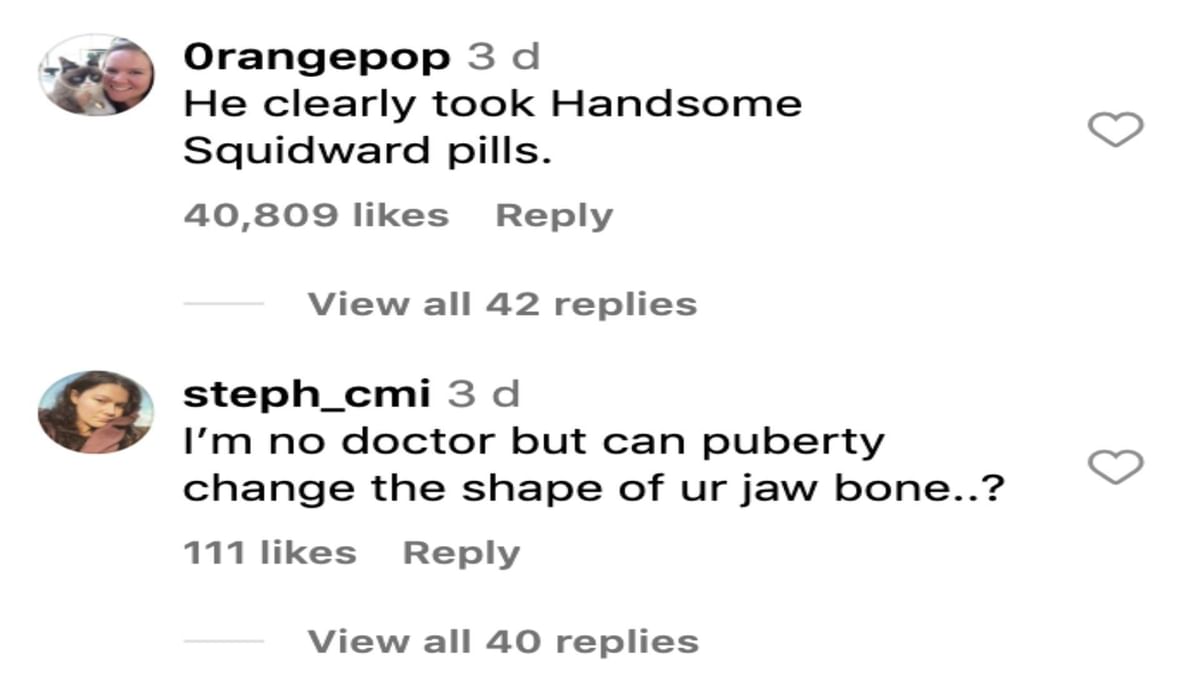 "He clearly took Handsome Squidward pills" Matt Rife jawline surgery