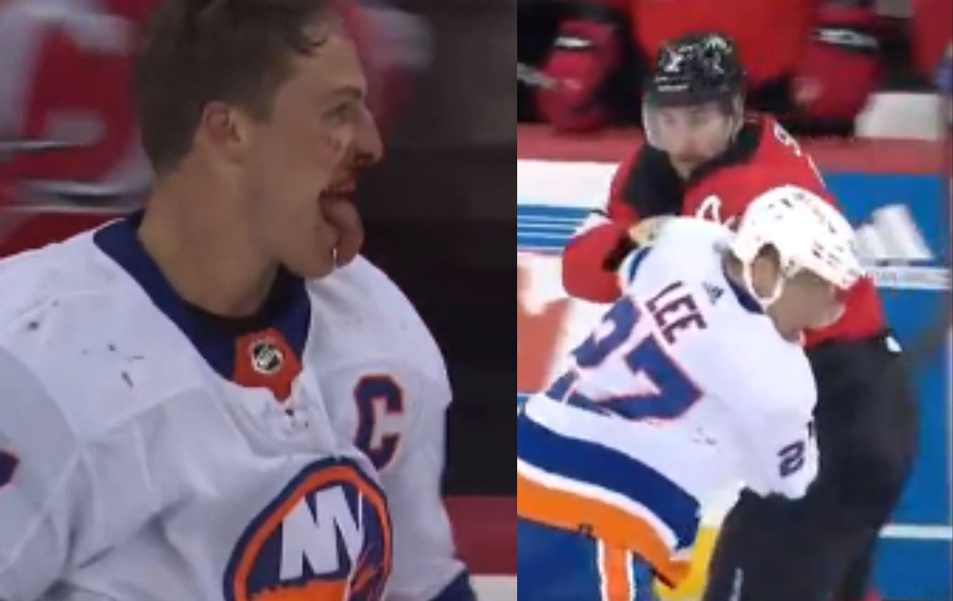 Anders Lee left bleeding after fight with Brendan Smith