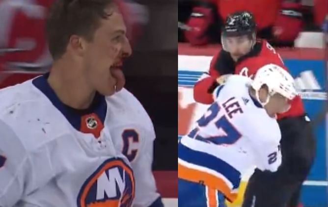Video: Anders Lee left bleeding profusely after spirited bout with Brendan Smith