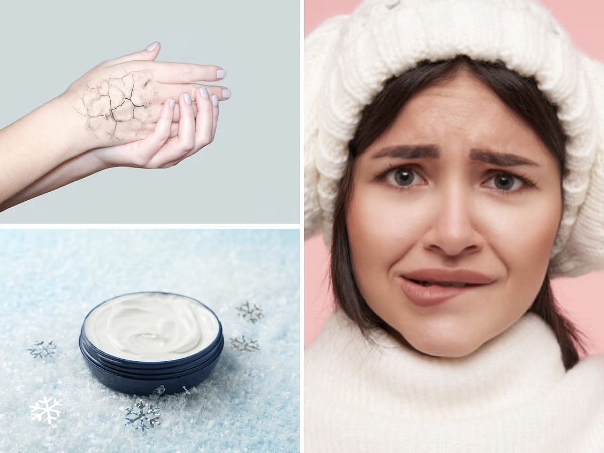 Common winter skin problems and fixing them like a pro (Image via Sportskeeda)