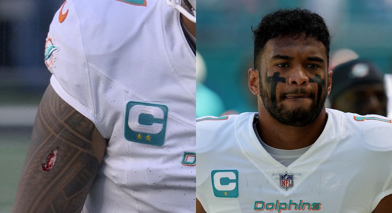 &ldquo;Gotta get stitched asap&rdquo;: NFL fans left stunned after seeing Tua Tagovailoa&rsquo;s wild cut on hand vs. Jets