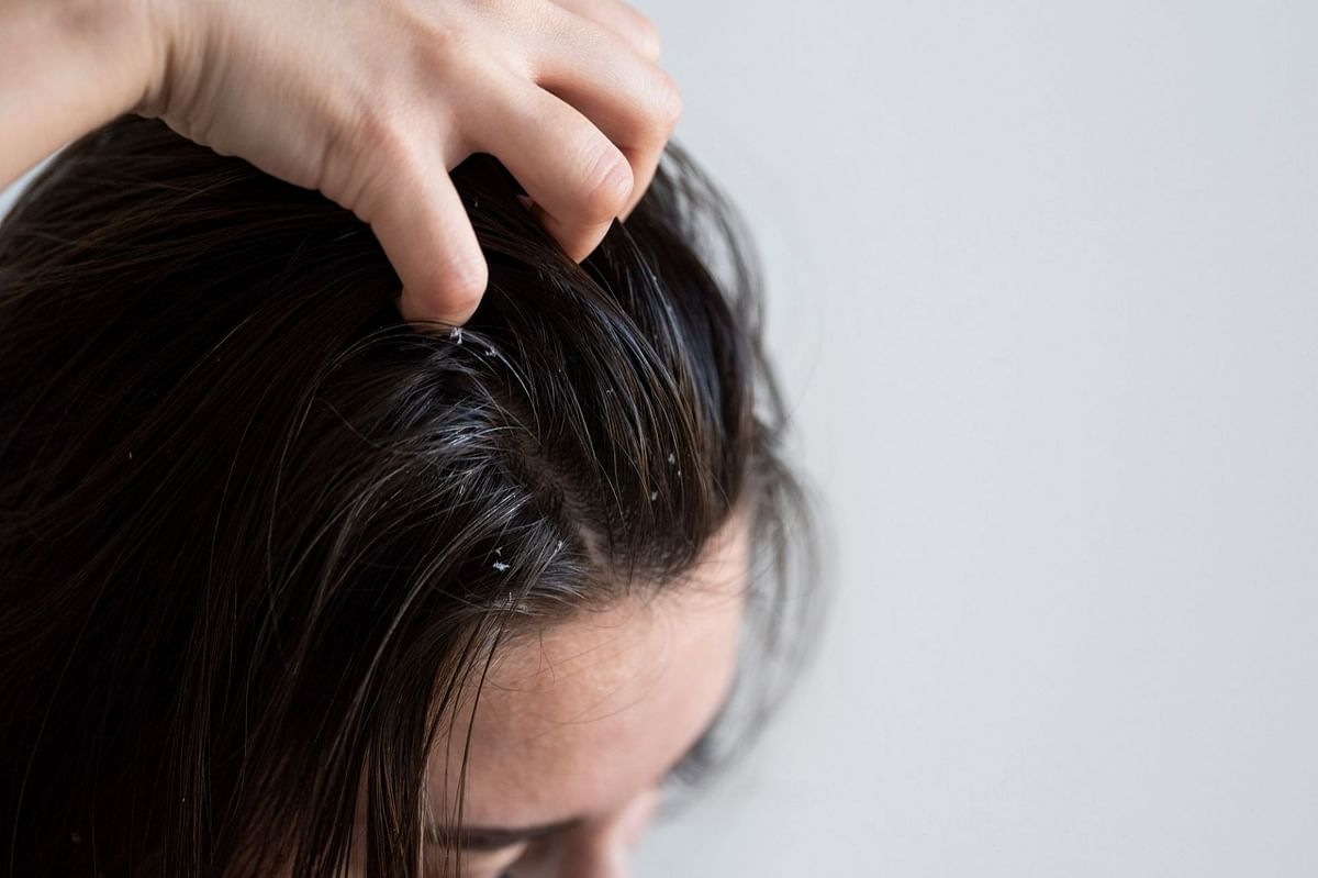 Reasons Why Your Hair Is Greasy After Washing