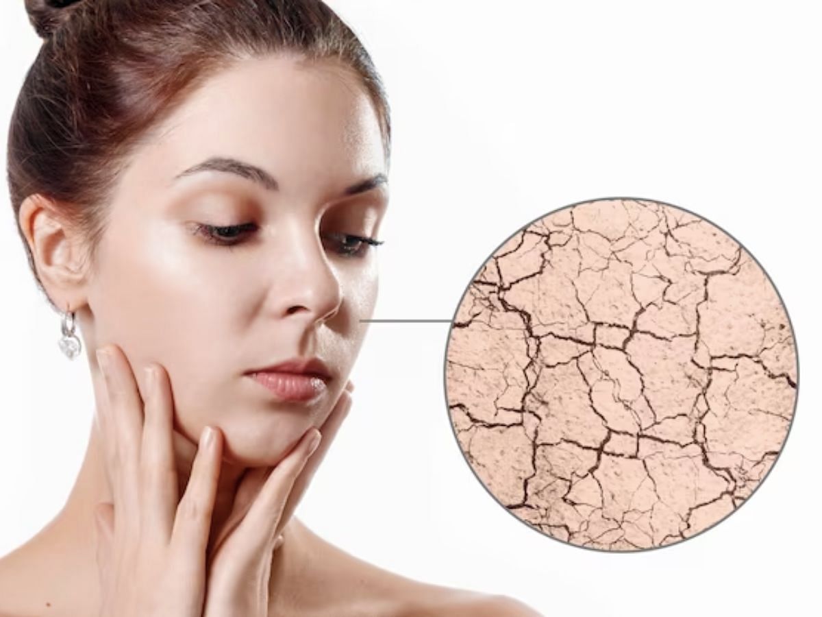 Dry and flaky skin (Image from Freepik)