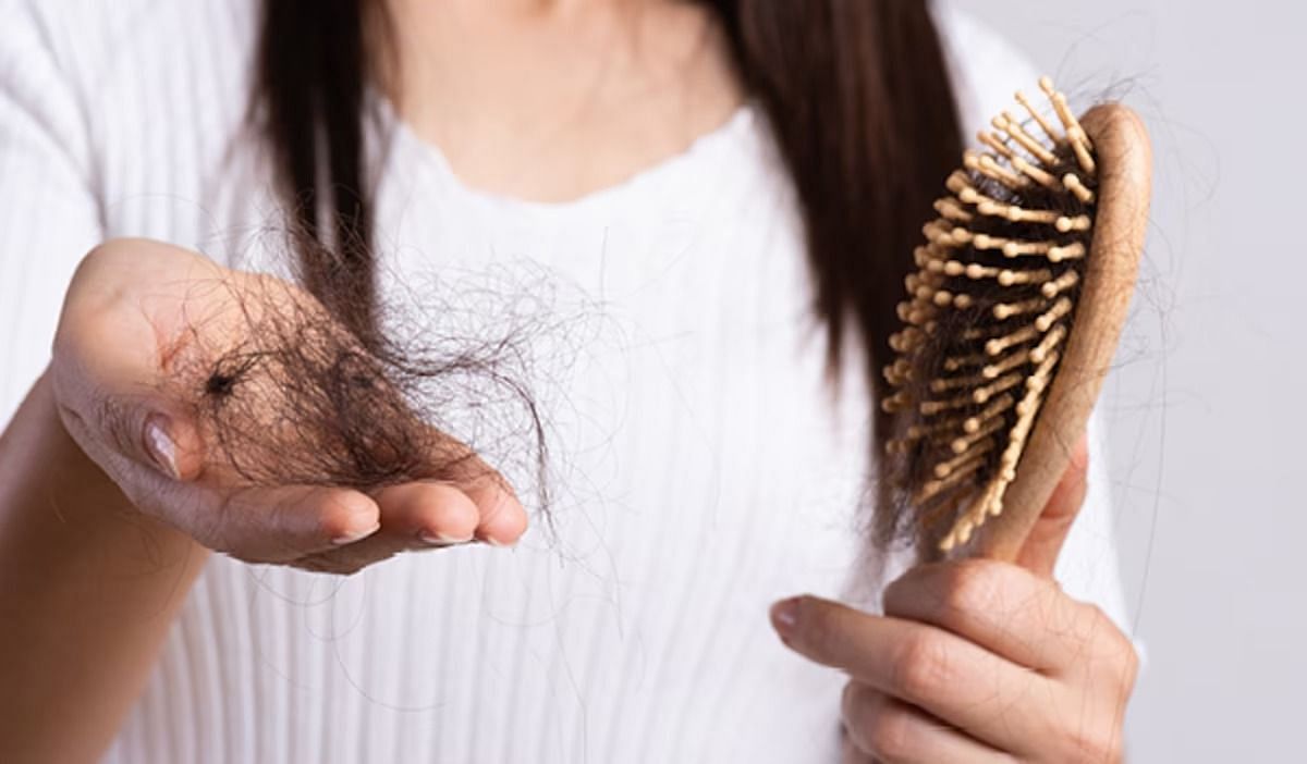 Hair shed in winter (Image via Getty Images)