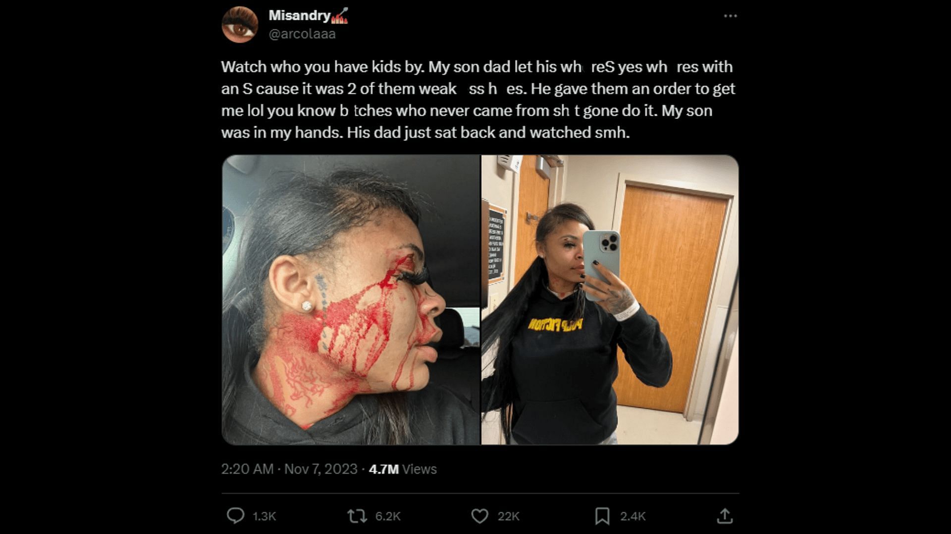 Arcola sharing her images and accusing YoungBoy and his companions of violence. (Image via X/arcolaaa)