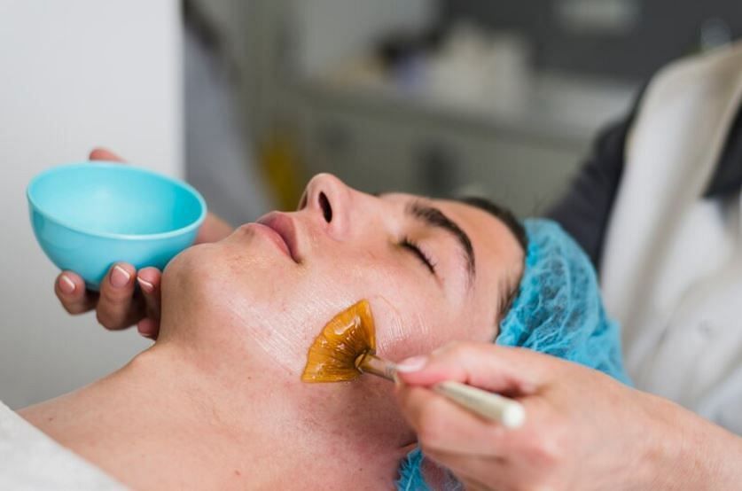 Chemical peels have their pros and cons (Image via Freepik)