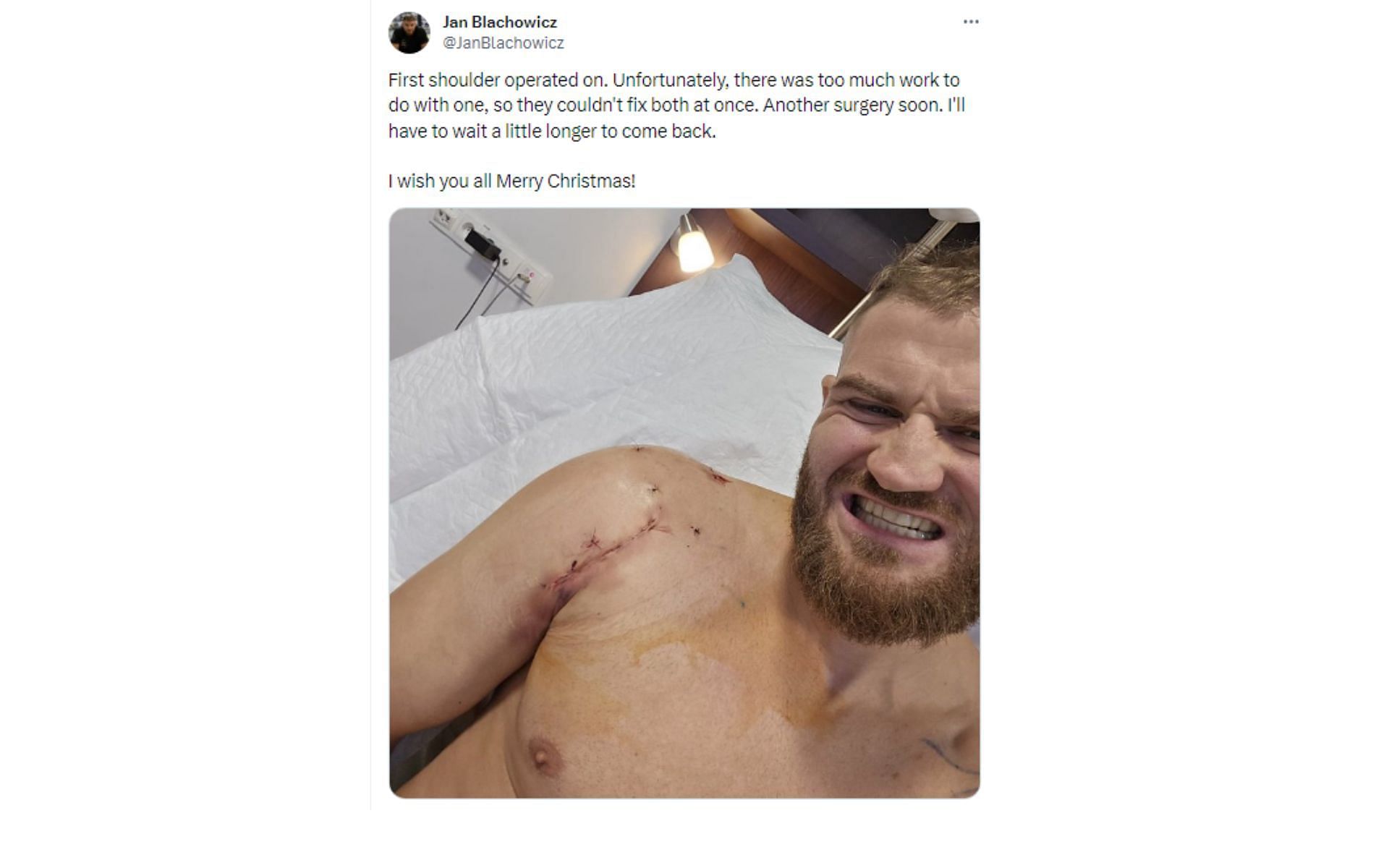 Tweet regarding Jan Blachowicz&#039;s surgery